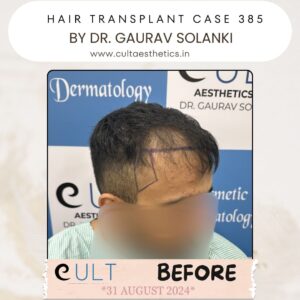 hair case 385 Before-3