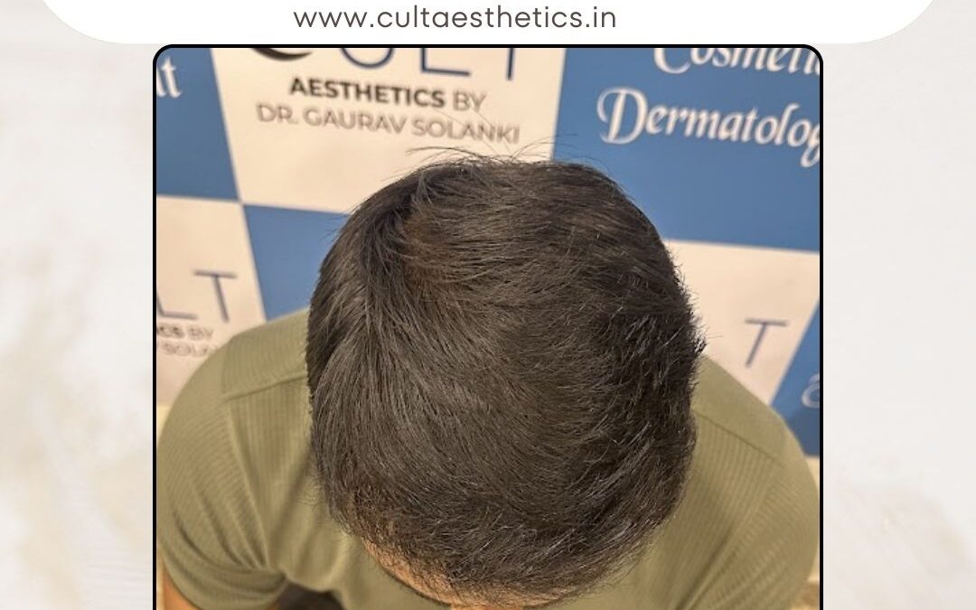 Hair Case 386 After 4