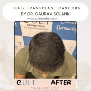 hair case 386 After-4