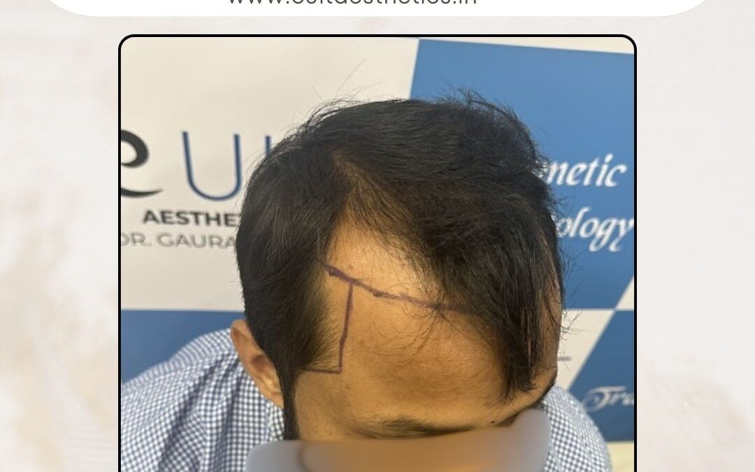 Hair Case 386 Before 2