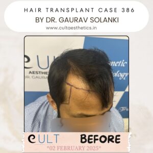 hair case 386 Before-2