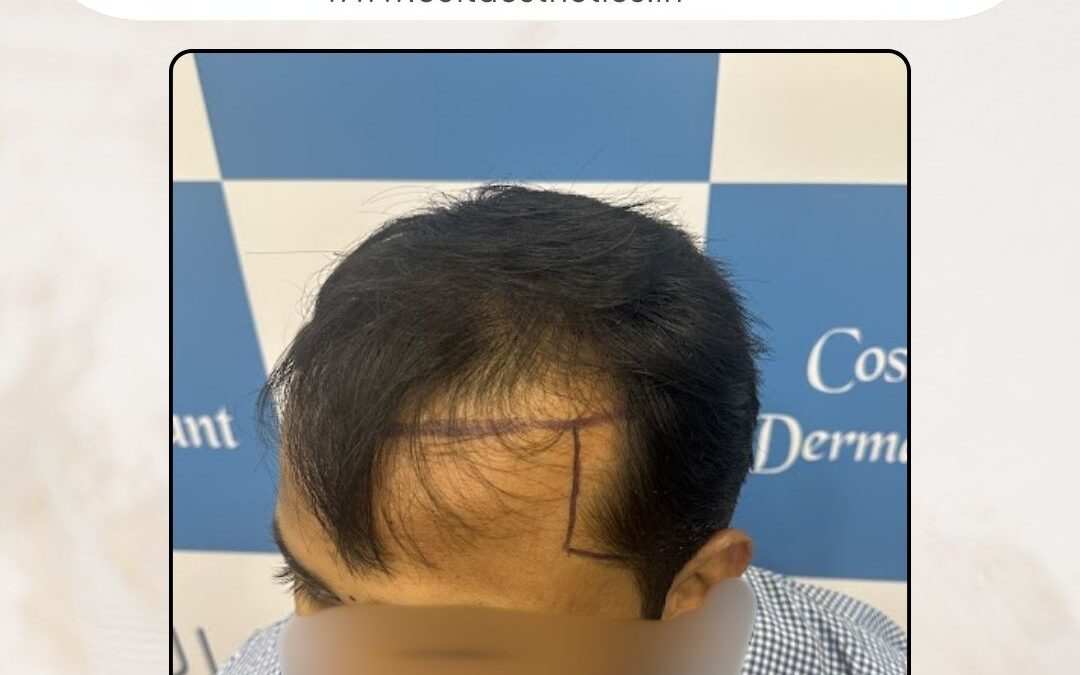 Hair Case 386 Before 3