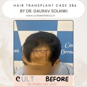hair case 386 Before-3
