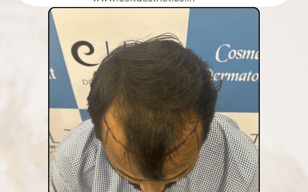 Hair Case 386 Before 4