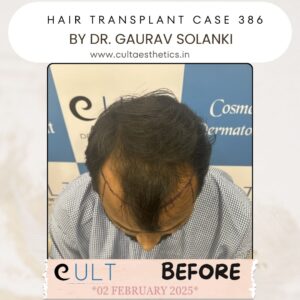 hair case 386 Before-4