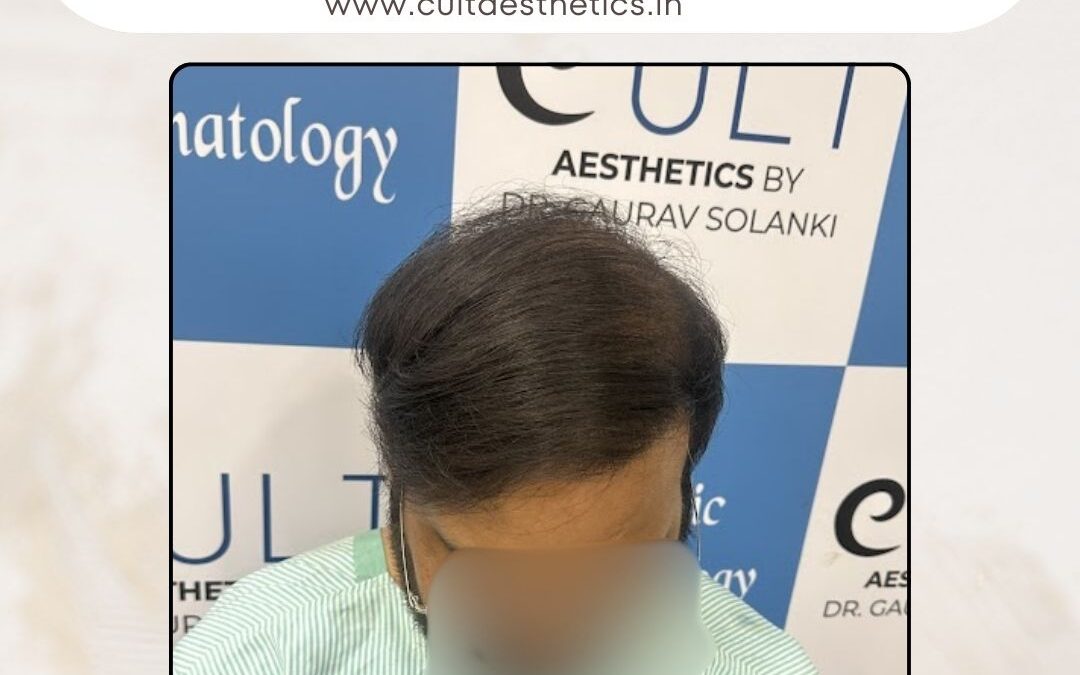 Hair Case 387 After 2