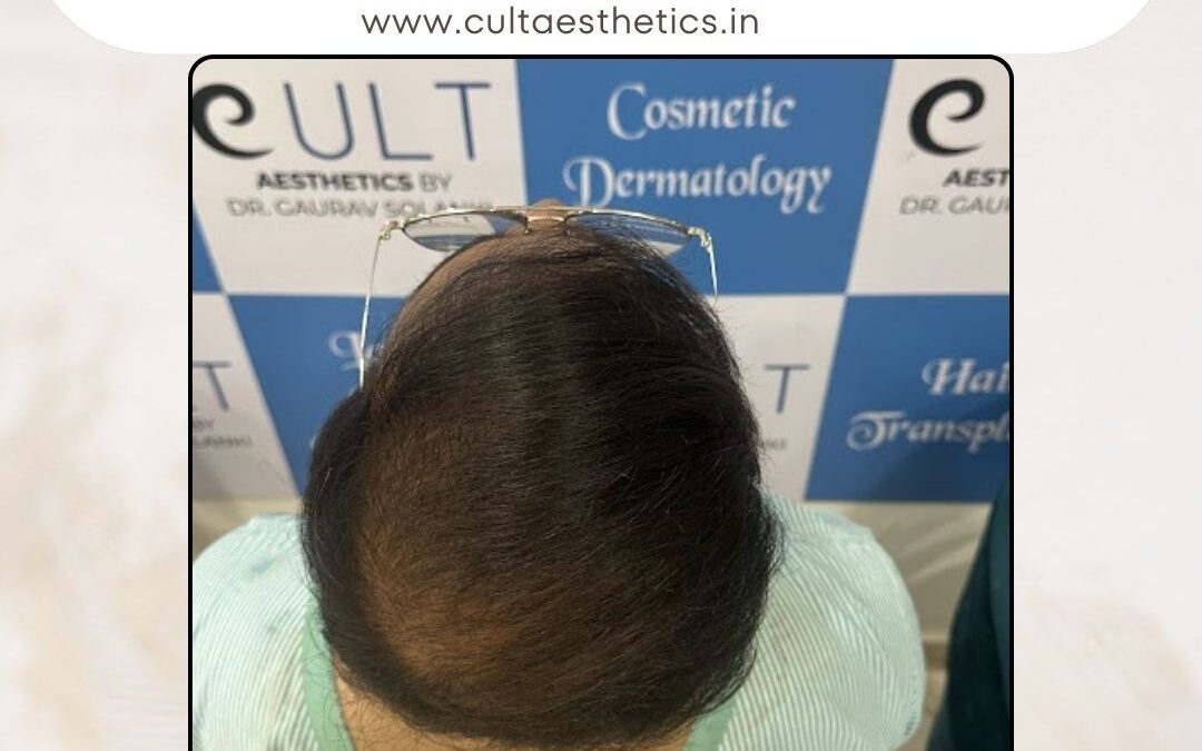 Hair Case 387 After 3