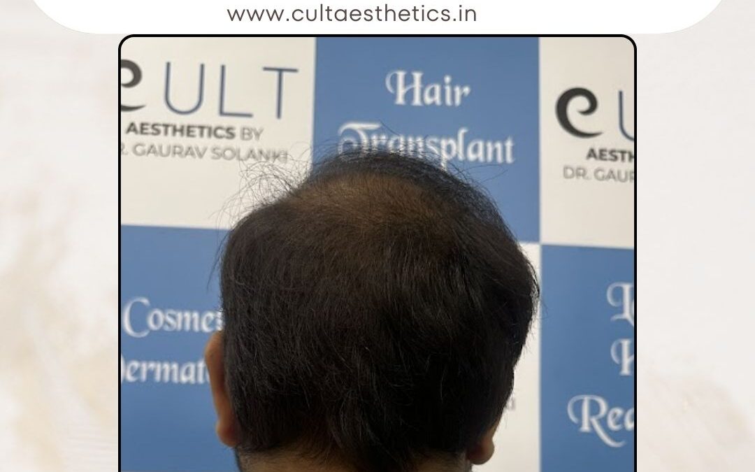 Hair Case 387 After 4