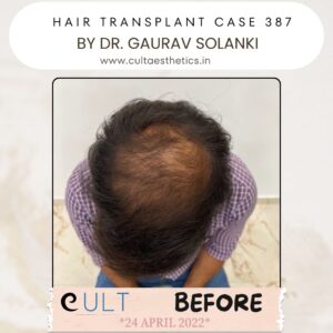 hair case 387 Before-2