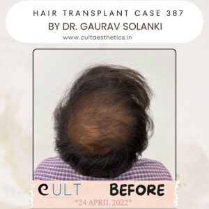 hair case 387 Before-3