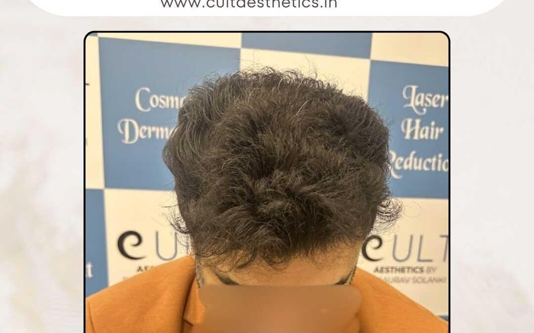 Hair Case 388 After 2