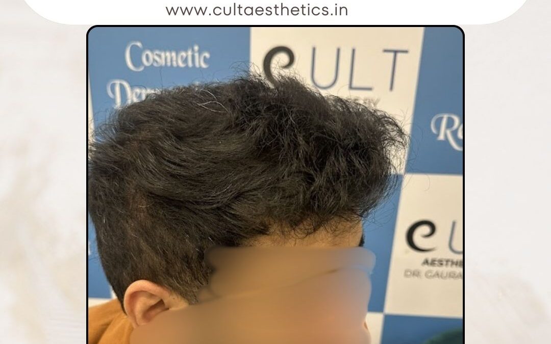 Hair Case 388 After 3