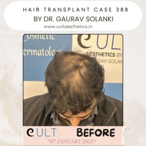 hair case 388 Before-2