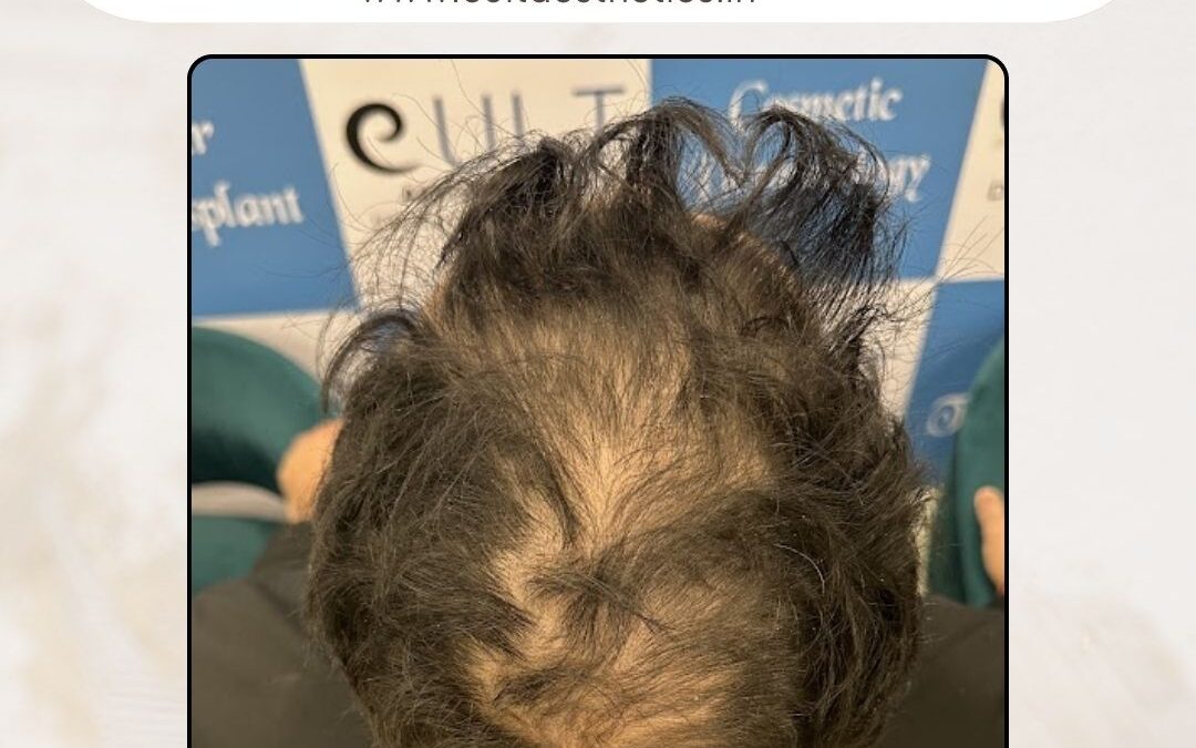 Hair Case 388 Before 3