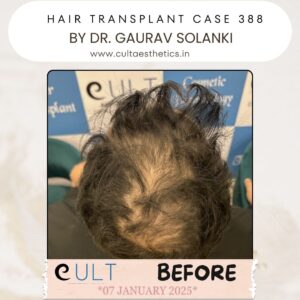 hair case 388 Before-3
