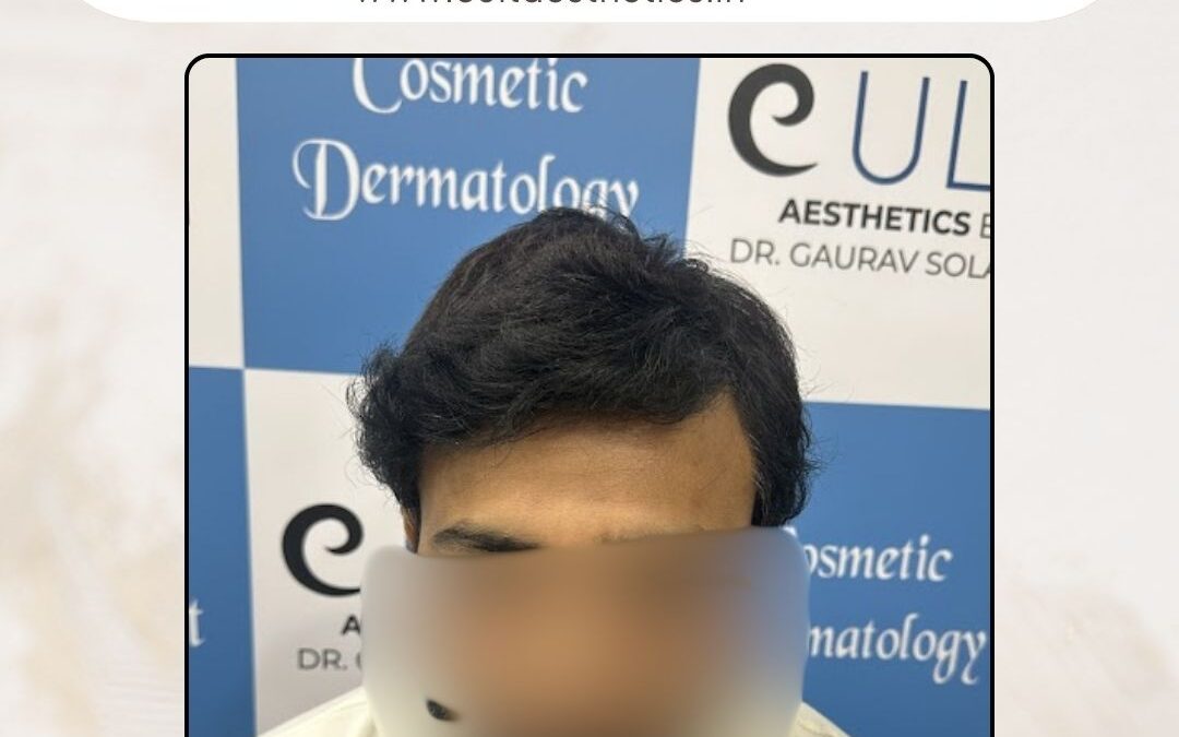 Hair Case 389 After 1