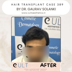 hair case 389 After-1
