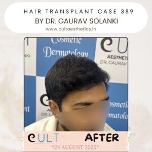 hair case 389 After-2