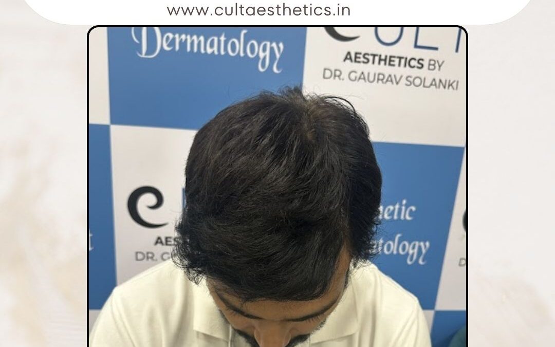 Hair Case 389 After 4