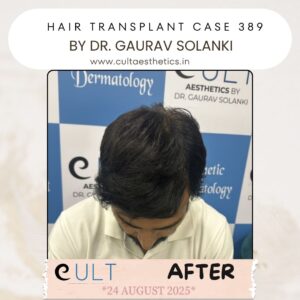 hair case 389 After-4