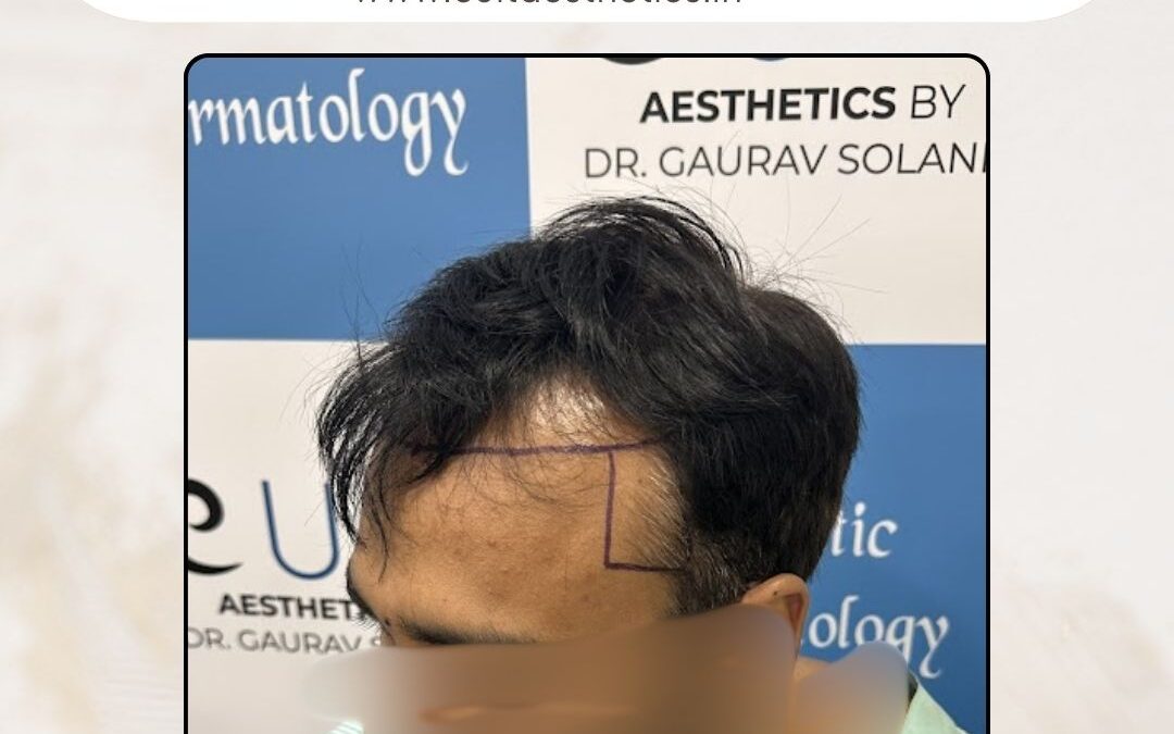 Hair Case 389 Before 3