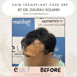 hair case 389 Before-3