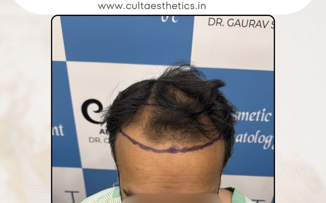 Hair Case 396 Before 1