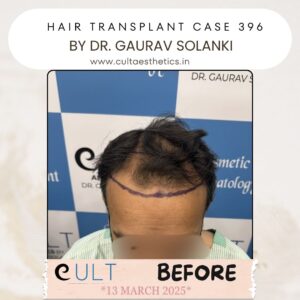 Hair case 396 Before-1