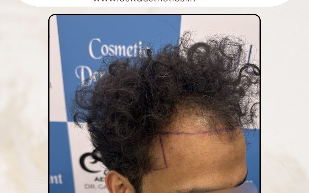 Hair Case 390 Before 2