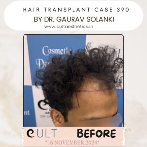 hair case 390 Before-2