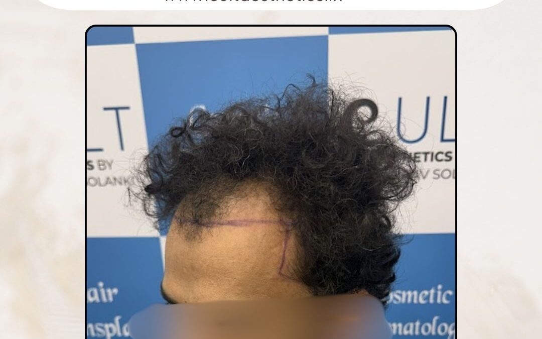 Hair Case 390 Before 3