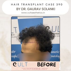 hair case 390 Before-3