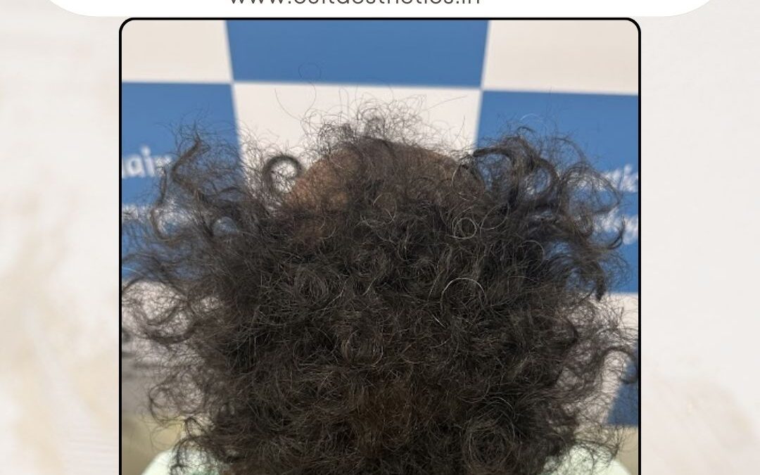 Hair Case 390 Before 4