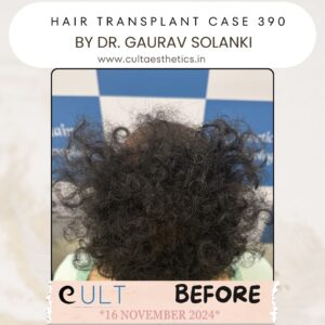 hair case 390 Before-4