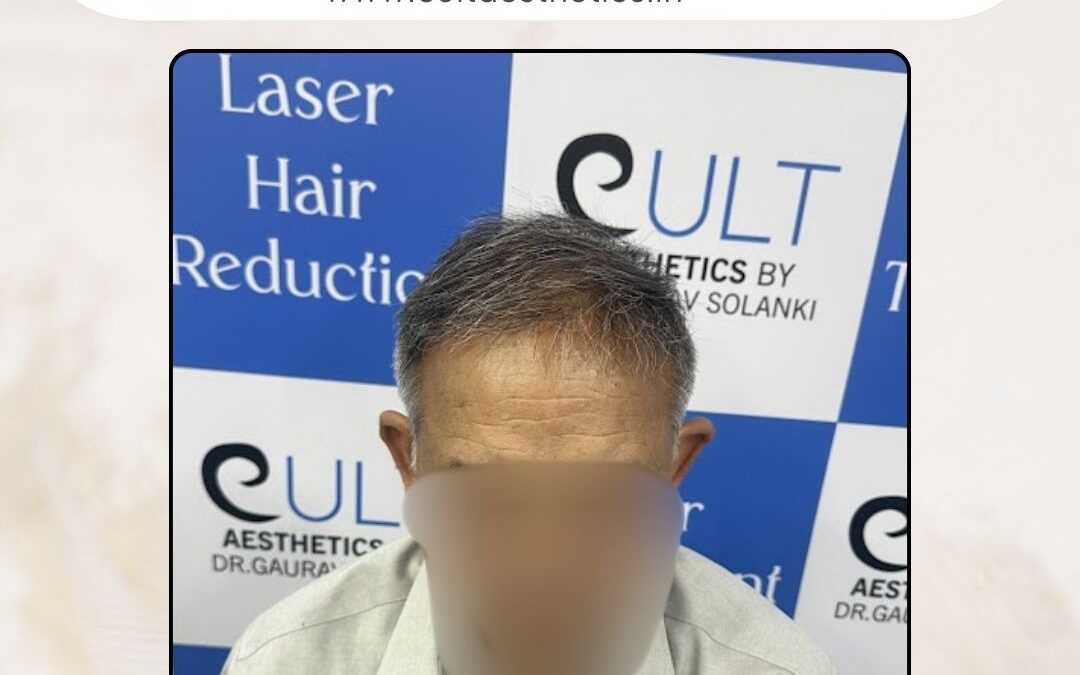 Hair Case 391 After 1