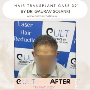 hair case 391 After-1
