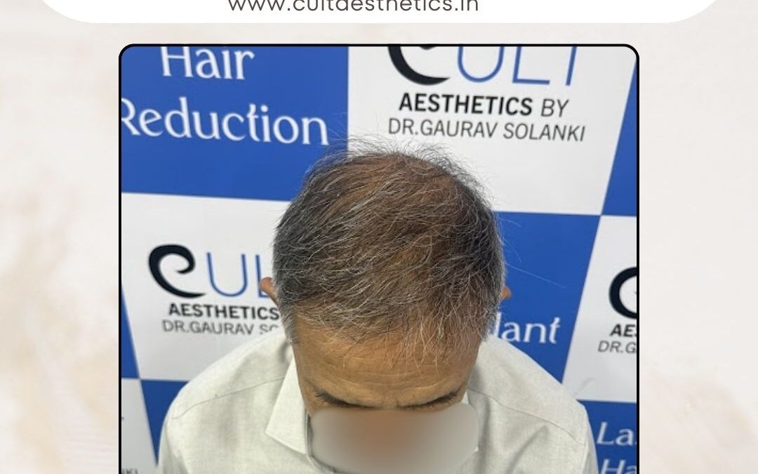 Hair Case 391 After 2