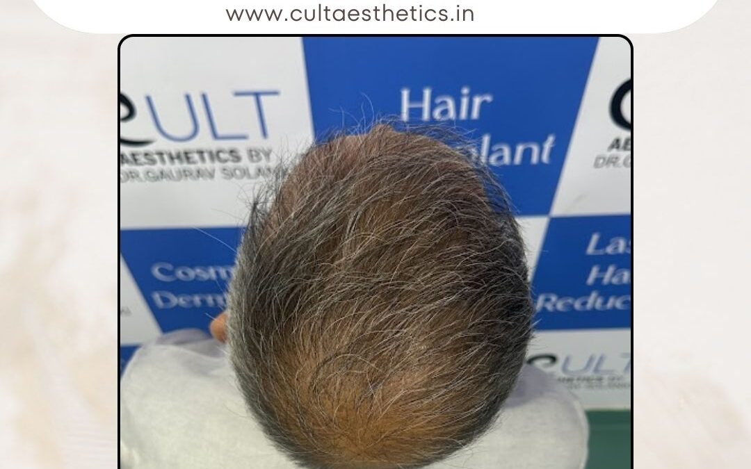 Hair Case 391 After 3