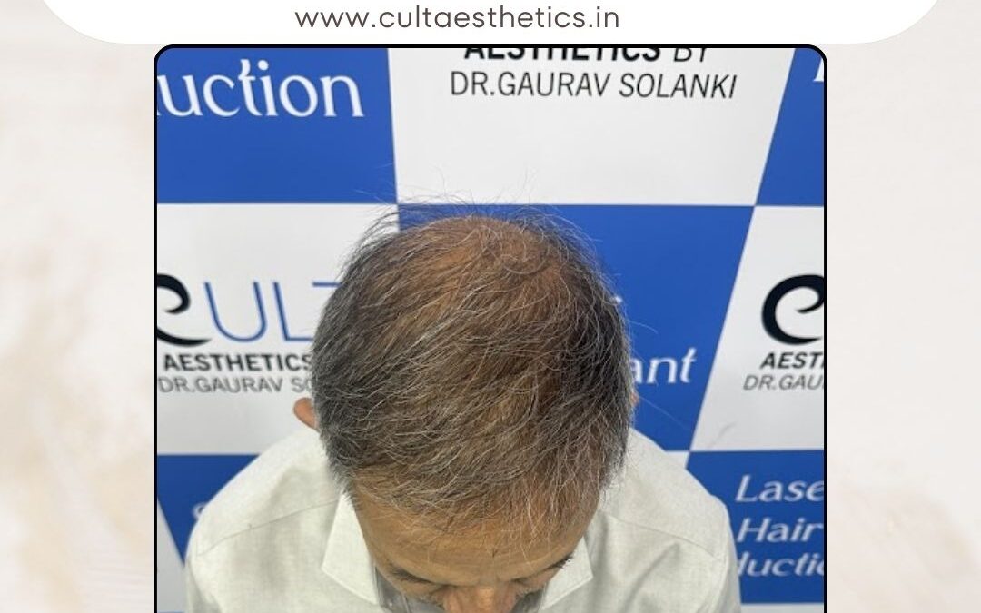 Hair Case 391 After 4