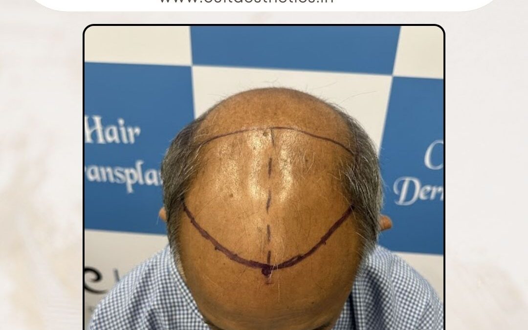 Hair Case 391 Before 2