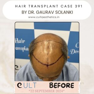 hair case 391 Before-2