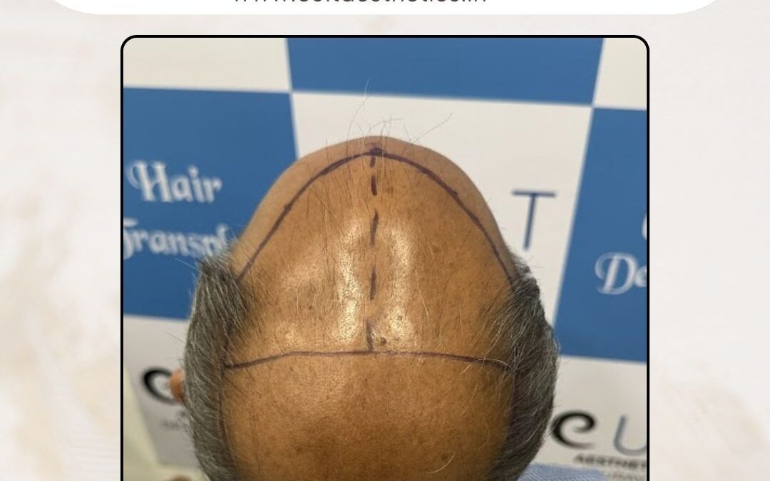 Hair Case 391 Before 3