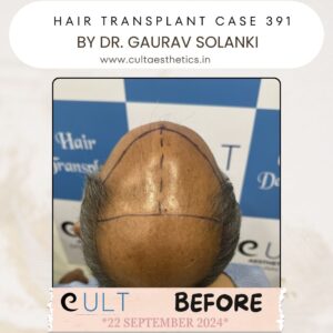 hair case 391 Before-3