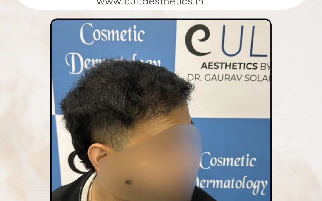 Hair Case 392 After 2