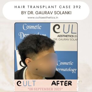 hair case 392 After-2