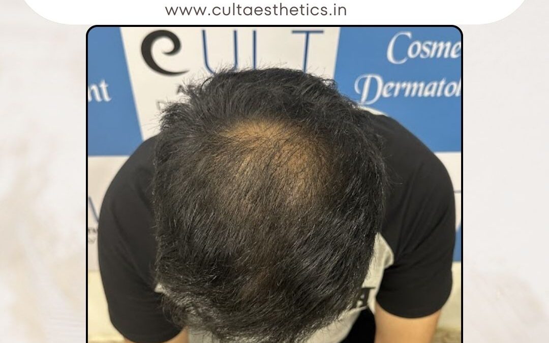 Hair Case 392 After 3