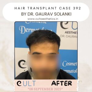 hair case 392 After-4