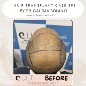 hair case 392 Before-3