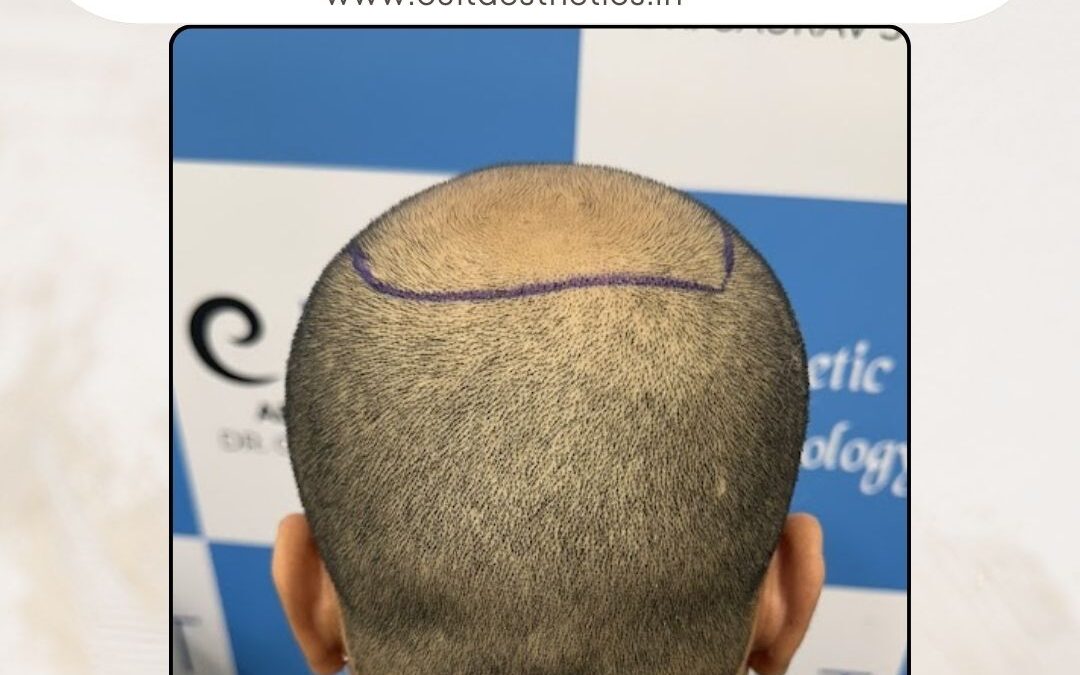 Hair Case 392 Before 4