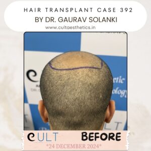 hair case 392 Before-4